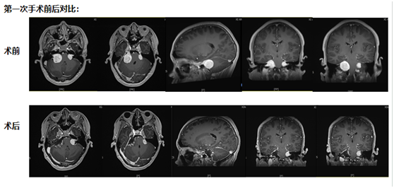 rZzyqeKcdR891tvj.png image.png